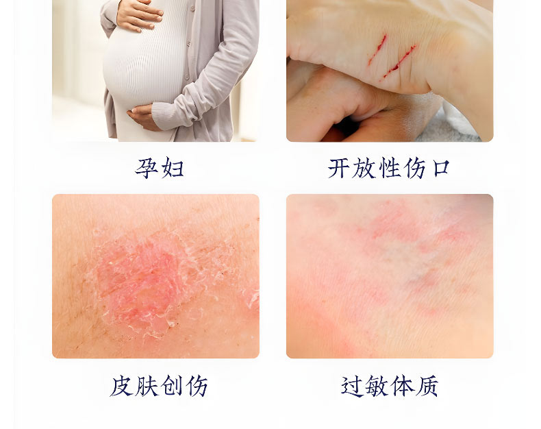 腰椎貼不適宜人群有哪些 腰椎貼不適宜人群有哪些