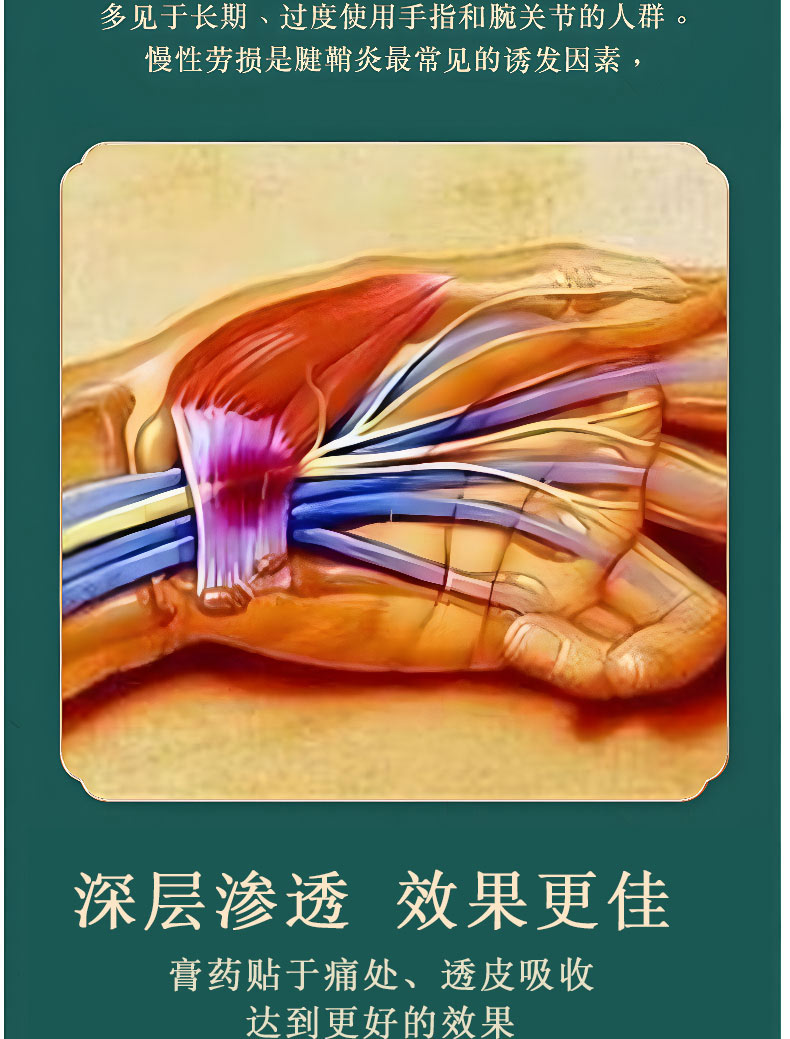 腱鞘炎膏藥貼深層滲透效果更佳 腱鞘炎膏藥貼深層滲透效果更佳