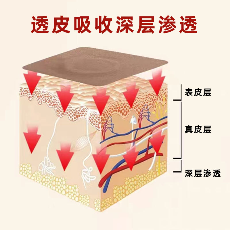 疝氣貼可以直達(dá)皮膚深層快速吸收 疝氣貼可以直達(dá)皮膚深層快速吸收