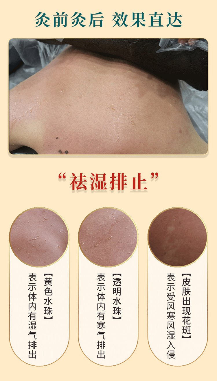 草本熱灸膏使用效果對比 草本熱灸膏使用效果對比