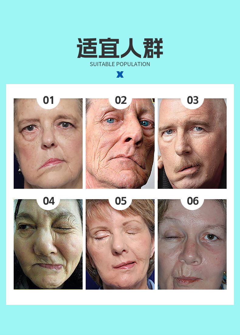 面癱貼適宜人群 面癱貼適宜人群